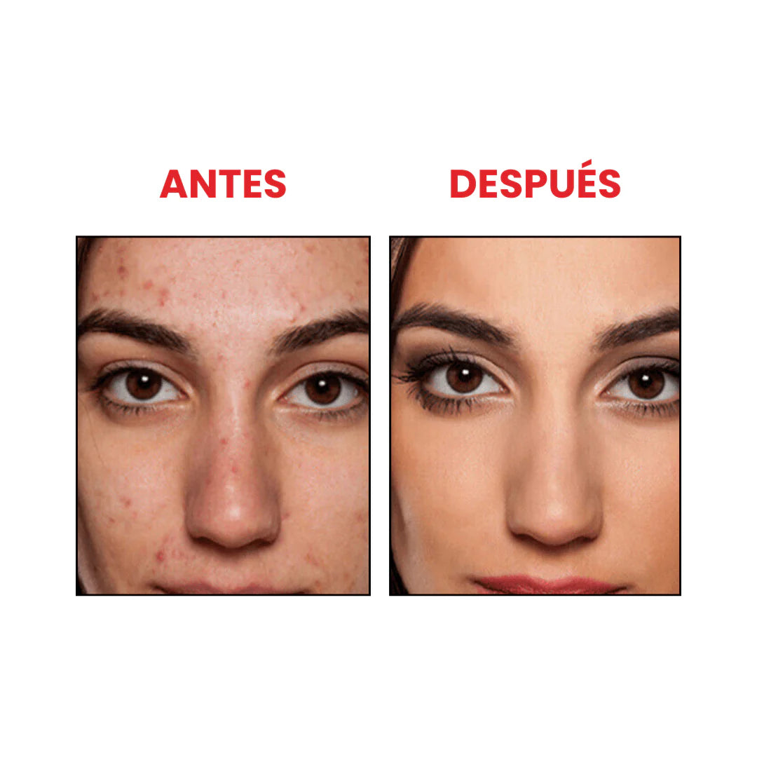 Anua® Suero de Niacinamida 10