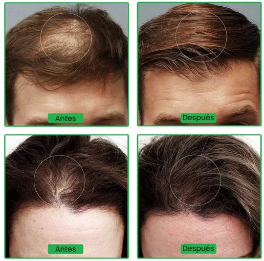 VITAORGANIC - SERUM CAPILAR